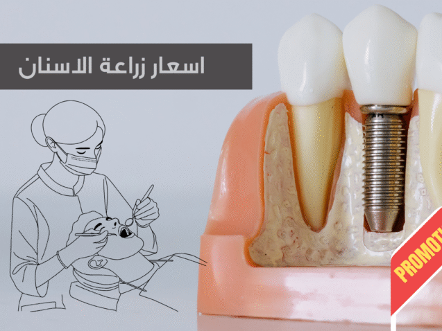 Grey Minimalist Tips Blog Banner