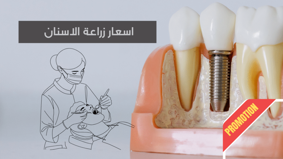 Grey Minimalist Tips Blog Banner